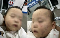 Tạm giữ bảo mẫu khiến bé gái 1 tuổi ở Bắc Ninh bị thương khi đi học