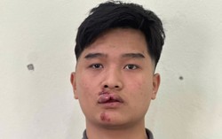 Hưng Yên: Khởi tố đối tượng tông xe vào đại úy CSGT tại chốt nồng độ cồn