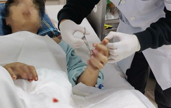 Liên tiếp ca cấp cứu đặc biệt nặng do pháo nổ dịp Tết Dương lịch