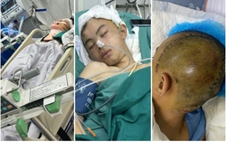 Khởi tố hành vi "Giết người" vụ nam sinh 14 tuổi ở Bắc Ninh bị đánh chấn thương sọ não