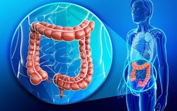 Ung thư đại tràng trở thành nguyên nhân hàng đầu gây tử vong do ung thư ở người dưới 50 tuổi tại Mỹ