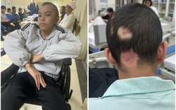 Nam sinh 14 tuổi ở Bắc Ninh bị đánh thương tích 61%