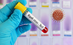 Virus Nipah: Cần giám sát dịch tễ sớm, ngăn chặn nguy cơ lây lan trong cộng đồng