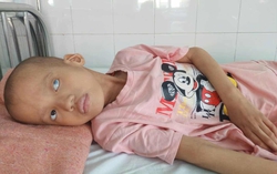 Ánh mắt cầu cứu của bé gái 7 tuổi bị mù lòa, mắc bệnh hiểm nghèo