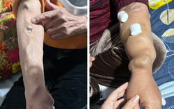 Những cánh tay biến dạng giữa mùa đông Hà Nội