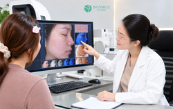 BonBoZ: Điều trị sẹo rỗ bắt đầu từ việc hiểu đúng cấu trúc sẹo