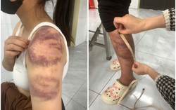 Tạm giữ người đàn ông nhiều lần trói, đánh đập con gái 13 tuổi và vợ đang mang thai