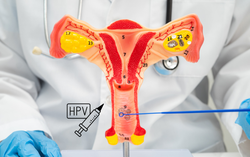 Điều trị thành công sùi mào gà cho phụ nữ mang thai