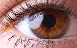 Phát hiện sớm để tránh mù lòa từ bệnh glocom