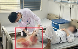 Suýt mất chân vì tự đắp lá chữa bỏng lửa suốt một tháng