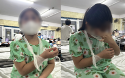 Huế: Học sinh lớp 4 bị chấn thương tay, cô giáo nhận dùng thước đánh