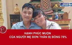 Hạnh phúc muộn của người mẹ đơn thân bị bỏng 78%