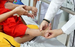 Yêu cầu tăng cường thu dung, điều trị khi ca mắc tay chân miệng tăng mạnh