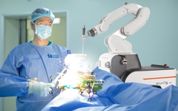 Lần đầu tiên tại Việt Nam: Thay khớp bằng Robot AI