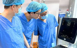 AI phát hiện ra nốt mờ khi tầm soát ung thư phổi