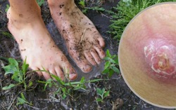 Bộ Y tế khuyến cáo bệnh từ bùn đất dễ bùng lên sau mưa lũ