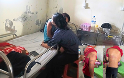 Người mẹ từ Nga về gặp con trai nghi bị bạo hành ở Nghệ An