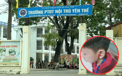 Bắc Ninh: Học sinh bị thầy giáo véo tai đến chảy máu