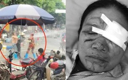 Khởi tố phụ nữ bán hải sản dùng vòi rửa xe xịt người bán rau gây thương tích
