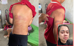 Nghệ An: Mẹ tố cha ruột bạo hành con trai 10 tuổi