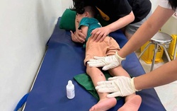 Khỉ hoang tấn công trẻ em ở biên giới Lạng Sơn