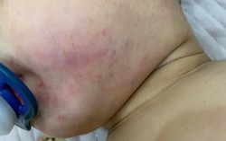 Công an Hà Nội tiếp nhận tố giác việc bé 2 tuổi bị tổn thương sau buổi học tại trung tâm Little Star