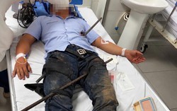 Kịp thời cứu bệnh nhân bị hai thanh sắt xuyên đùi và bụng
