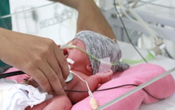 Cứu sống mẹ con sản phụ bị nhau bong non thể nặng