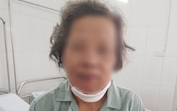 Đi khám sâu răng, phát hiện bị ung thư hiếm gặp giai đoạn 4