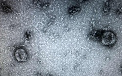 Việt Nam là 1 trong 4 nước phân lập thành công virus corona chủng mới