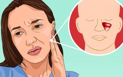 5 nguyên nhân gây đau răng mà không phải do vấn đề răng miệng