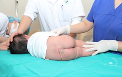 Bác sĩ tá hỏa khi trẻ sinh ra có chiếc đuôi dài 9,5cm