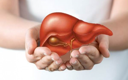 5 triệu chứng xơ gan cổ trướng điển hình