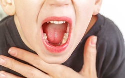 Viêm VA là gì? Tổng hợp những điều cần biết về viêm VA