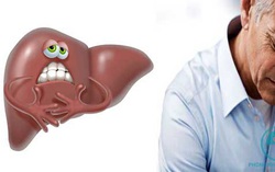 Các biến chứng xơ gan ở người cao tuổi nguy hiểm cần đề phòng