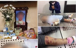 Vụ cha dượng và mẹ bạo hành con đến chết: Khởi tố vụ án giết người