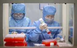 Chủ tịch Hà Nội nói về việc Bộ Công an triệu tập cán bộ CDC mua máy xét nghiệm Covid-19