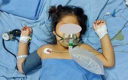 Rùng mình với búi tóc nặng 600g trong bụng bé gái 5 tuổi