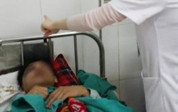 Khuôn mặt biến dạng vì súng hoa cải