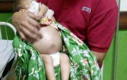 Thai nhi phát triển trong bụng bé trai 10 tháng tuổi