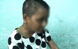 Hội LHPN Kon Tum lên tiếng trước vụ người làm nghi bị chủ bạo hành dã man