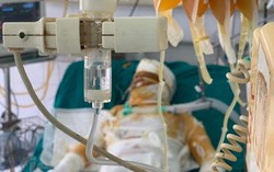 Tận cùng nỗi đau của gia đình người phụ nữ bị tẩm xăng đốt