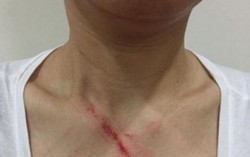 Nhắc không nhổ bậy trong thang máy, 1 phụ nữ bị đánh túi bụi