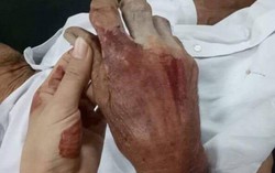 Mâu thuẫn đất đai, con trai đánh đập cha mẹ hơn 80 tuổi