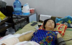 Níu kéo không thành, chồng chém lìa bàn tay vợ