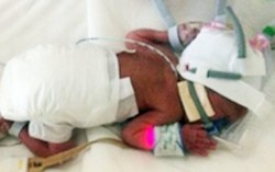 97 ngày giành sự sống cho con trai chỉ nặng 0,9kg