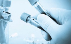 Thử nghiệm thành công vaccine chống ung thư 