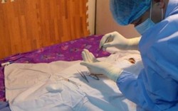 Ghép thành công giác mạc của bé Hải An hiến tặng 2 bệnh nhân