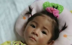 'Bé gái 14 tháng nặng 3,5kg' tăng cân 'thần kỳ'