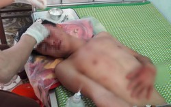Truy bắt 3 thanh niên xông vào trường đánh thầy giáo nhập viện